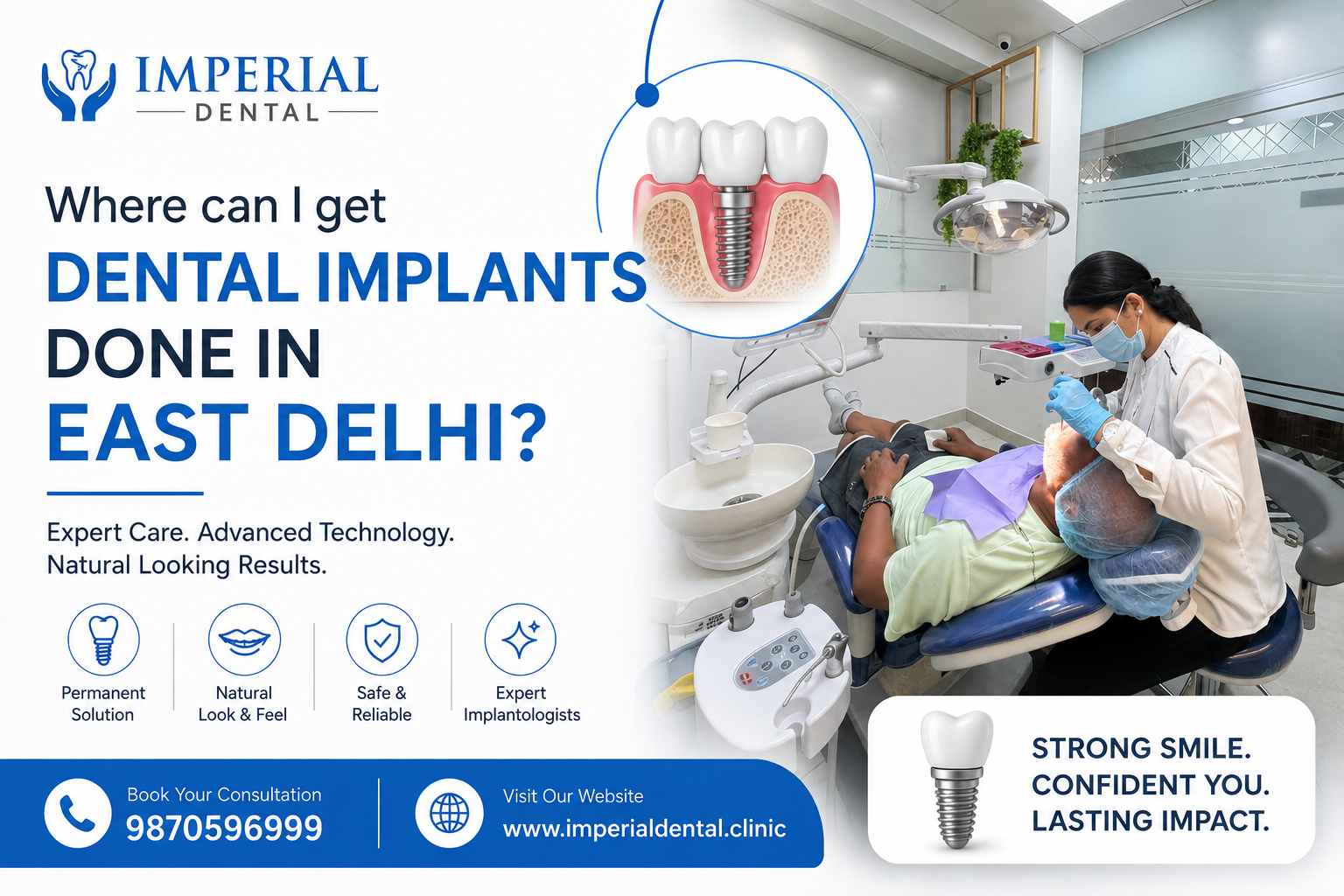 Where to Get Dental Implants Done in East Delhi?